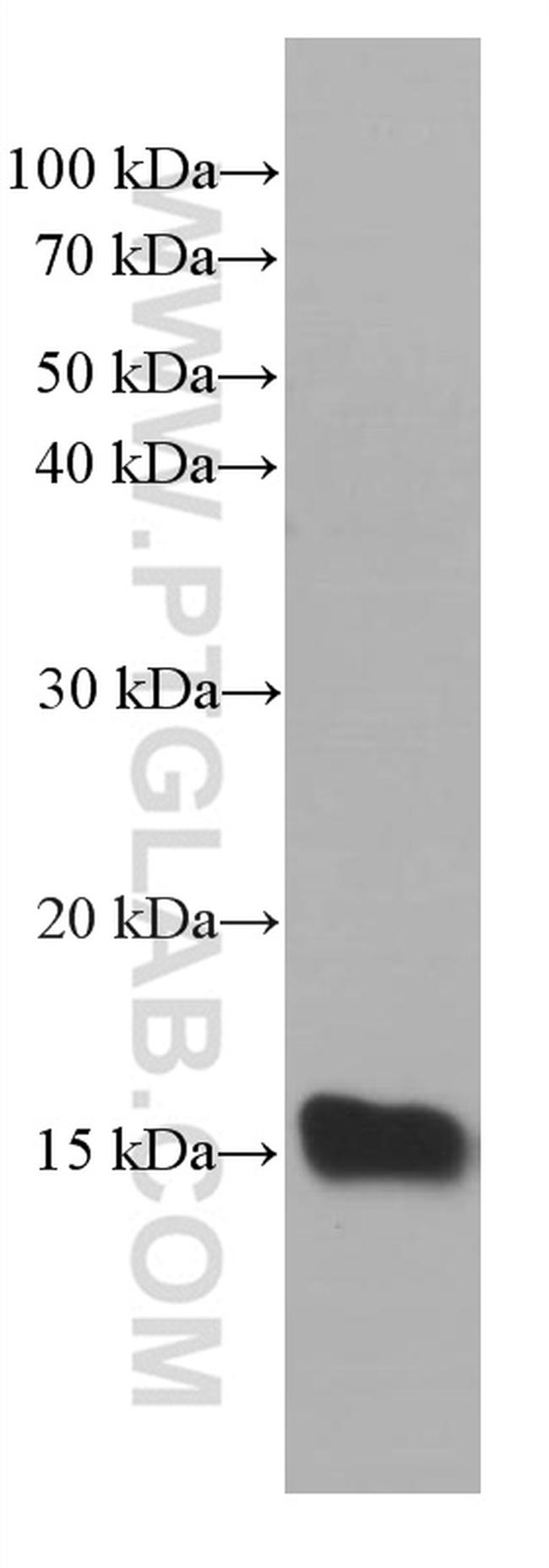 TFF2 Antibody in Western Blot (WB)