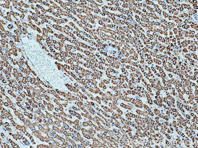 SOD2 Antibody in Immunohistochemistry (Paraffin) (IHC (P))