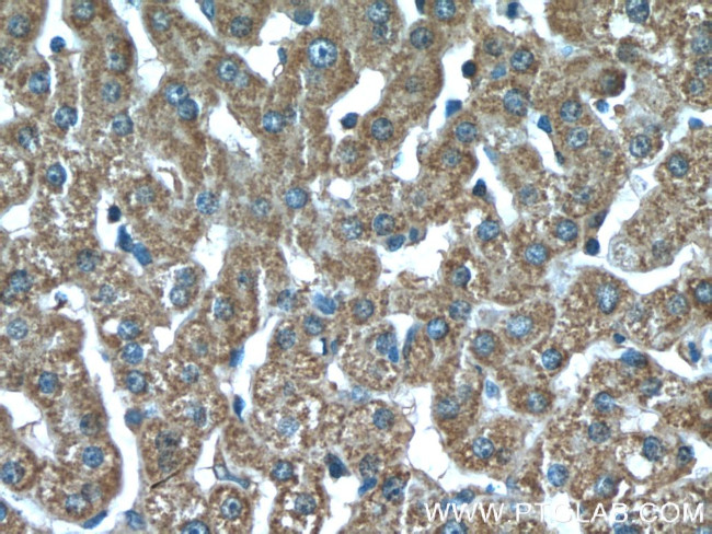 SOD2 Antibody in Immunohistochemistry (Paraffin) (IHC (P))