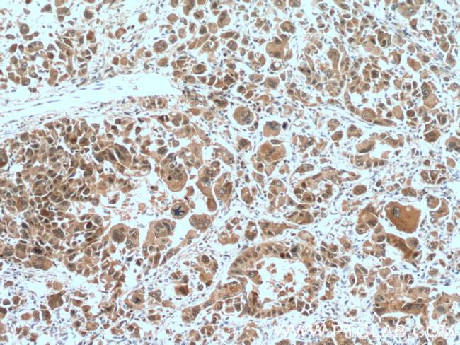 TXN Antibody in Immunohistochemistry (Paraffin) (IHC (P))