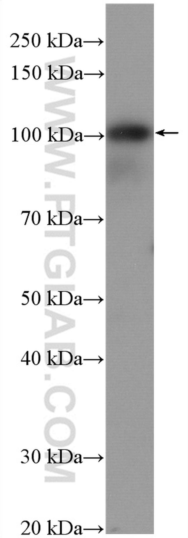 EZH2 Antibody in Western Blot (WB)