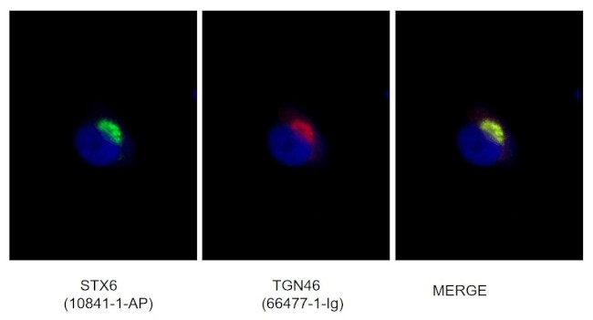 TGN46 Antibody in Immunocytochemistry (ICC/IF)