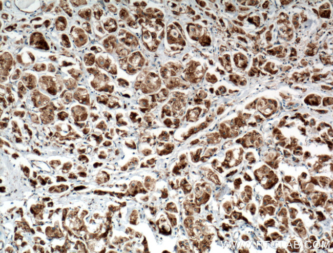 TGN46 Antibody in Immunohistochemistry (Paraffin) (IHC (P))