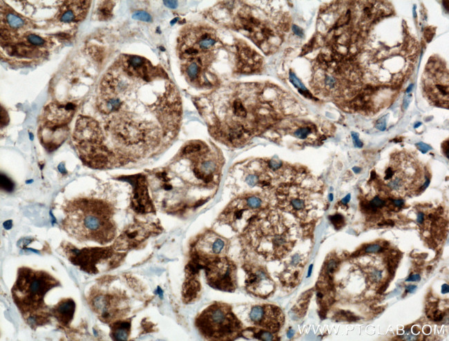 TGN46 Antibody in Immunohistochemistry (Paraffin) (IHC (P))