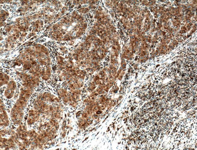 TGN46 Antibody in Immunohistochemistry (Paraffin) (IHC (P))