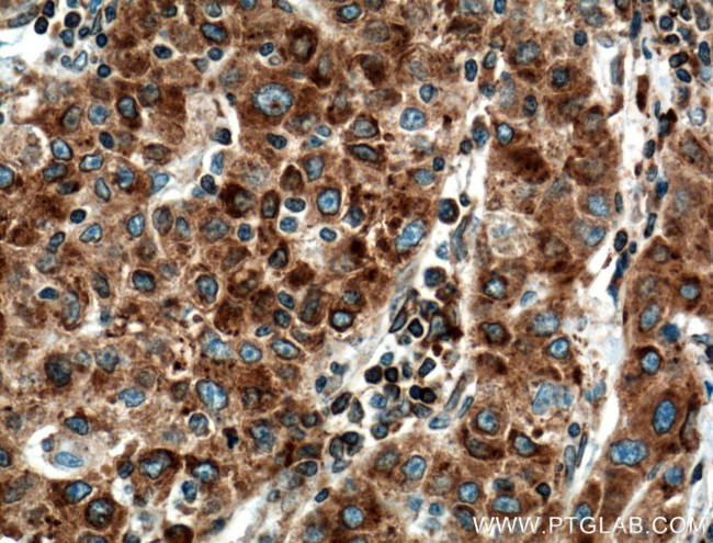 TGN46 Antibody in Immunohistochemistry (Paraffin) (IHC (P))