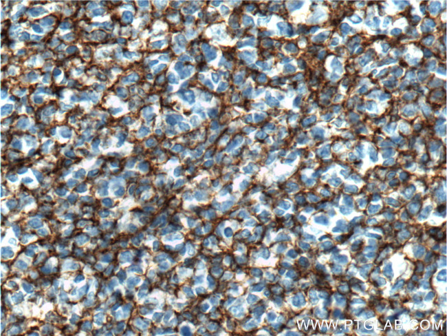 B7-H3 Antibody in Immunohistochemistry (Paraffin) (IHC (P))