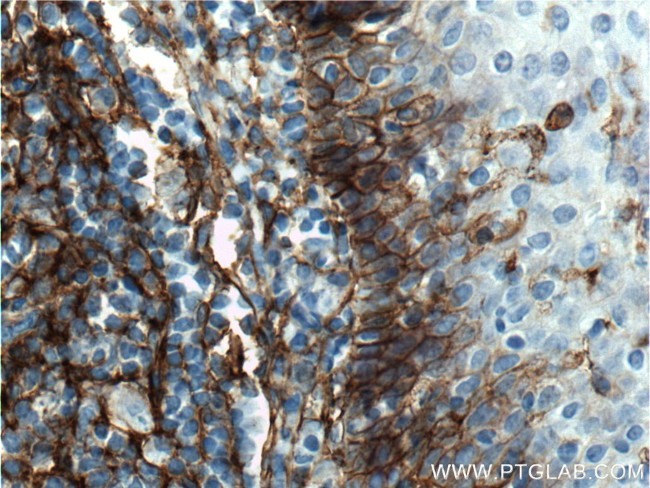 B7-H3 Antibody in Immunohistochemistry (Paraffin) (IHC (P))