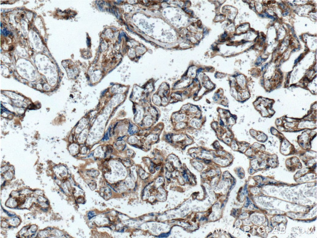 B7-H3 Antibody in Immunohistochemistry (Paraffin) (IHC (P))