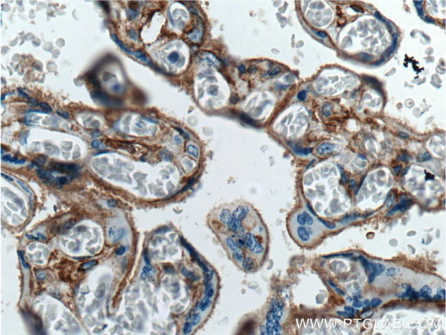 B7-H3 Antibody in Immunohistochemistry (Paraffin) (IHC (P))