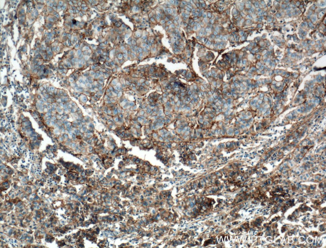 B7-H3 Antibody in Immunohistochemistry (Paraffin) (IHC (P))