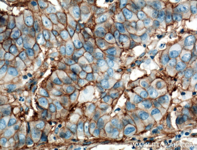 B7-H3 Antibody in Immunohistochemistry (Paraffin) (IHC (P))