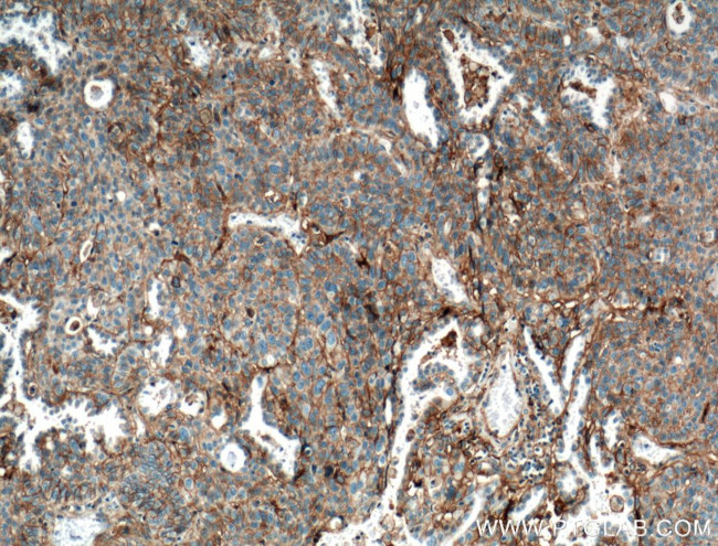 B7-H3 Antibody in Immunohistochemistry (Paraffin) (IHC (P))