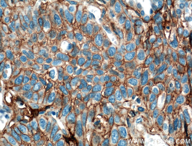 B7-H3 Antibody in Immunohistochemistry (Paraffin) (IHC (P))