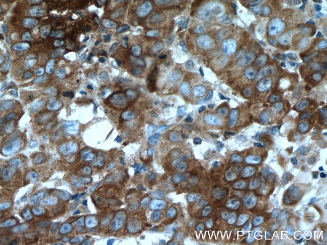 EIF2A Antibody in Immunohistochemistry (Paraffin) (IHC (P))