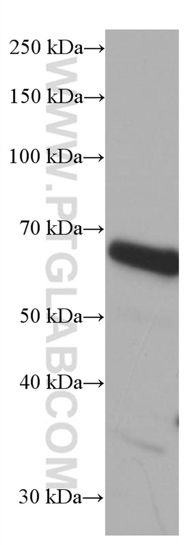 EIF2A Antibody in Western Blot (WB)