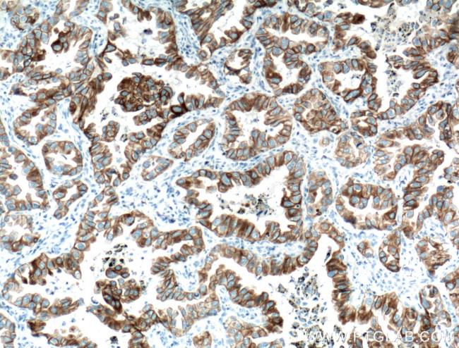 Cytokeratin 7 Antibody in Immunohistochemistry (Paraffin) (IHC (P))