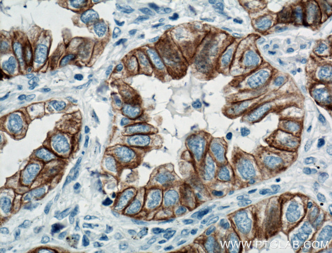 Cytokeratin 7 Antibody in Immunohistochemistry (Paraffin) (IHC (P))