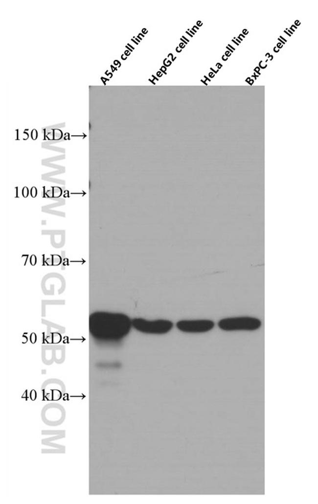 Cytokeratin 7 Antibody in Western Blot (WB)