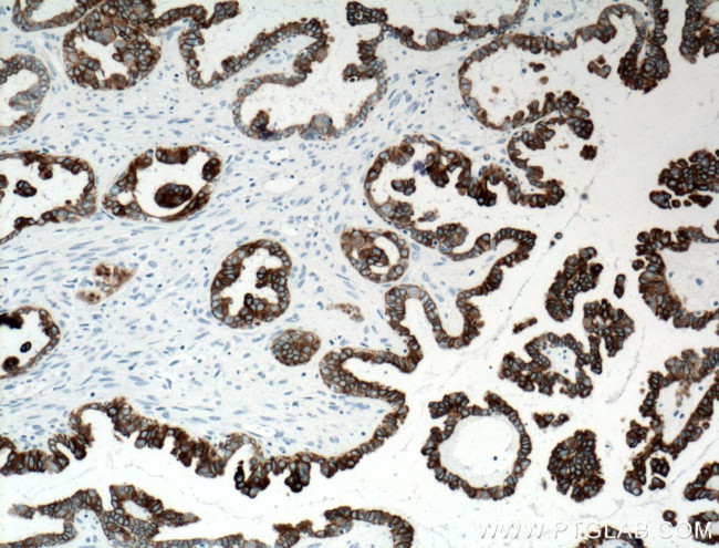 Cytokeratin 7 Antibody in Immunohistochemistry (Paraffin) (IHC (P))