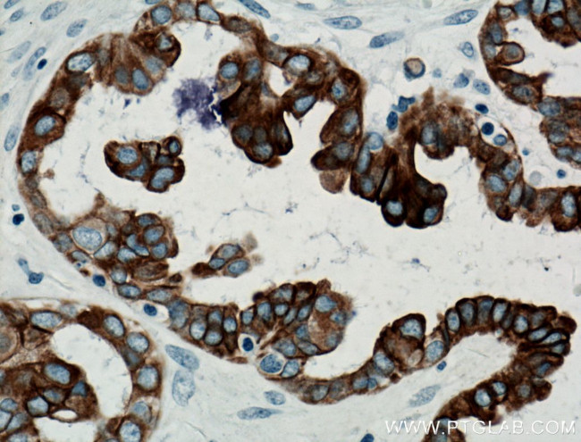 Cytokeratin 7 Antibody in Immunohistochemistry (Paraffin) (IHC (P))