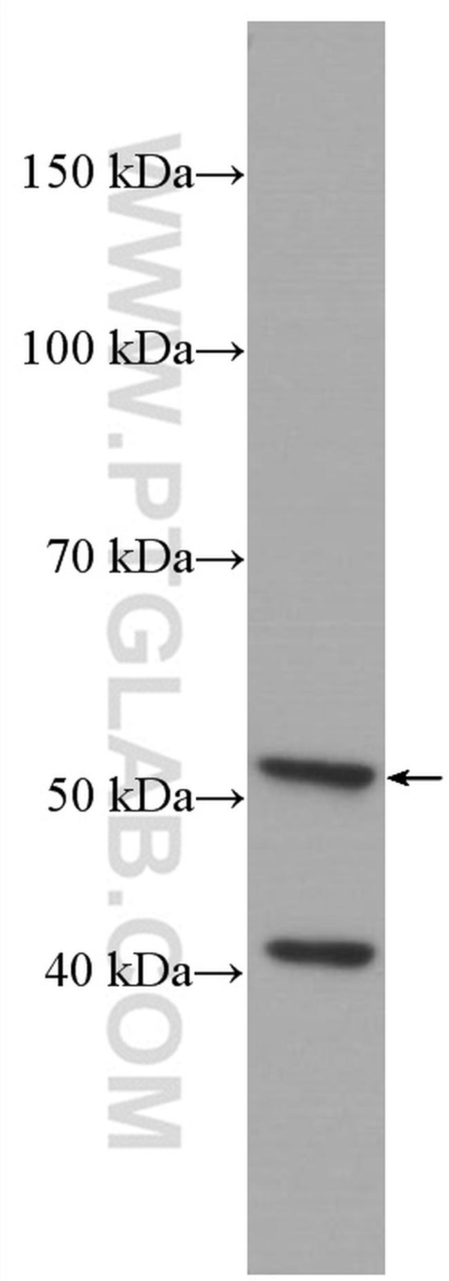 Cytokeratin 7 Antibody in Western Blot (WB)