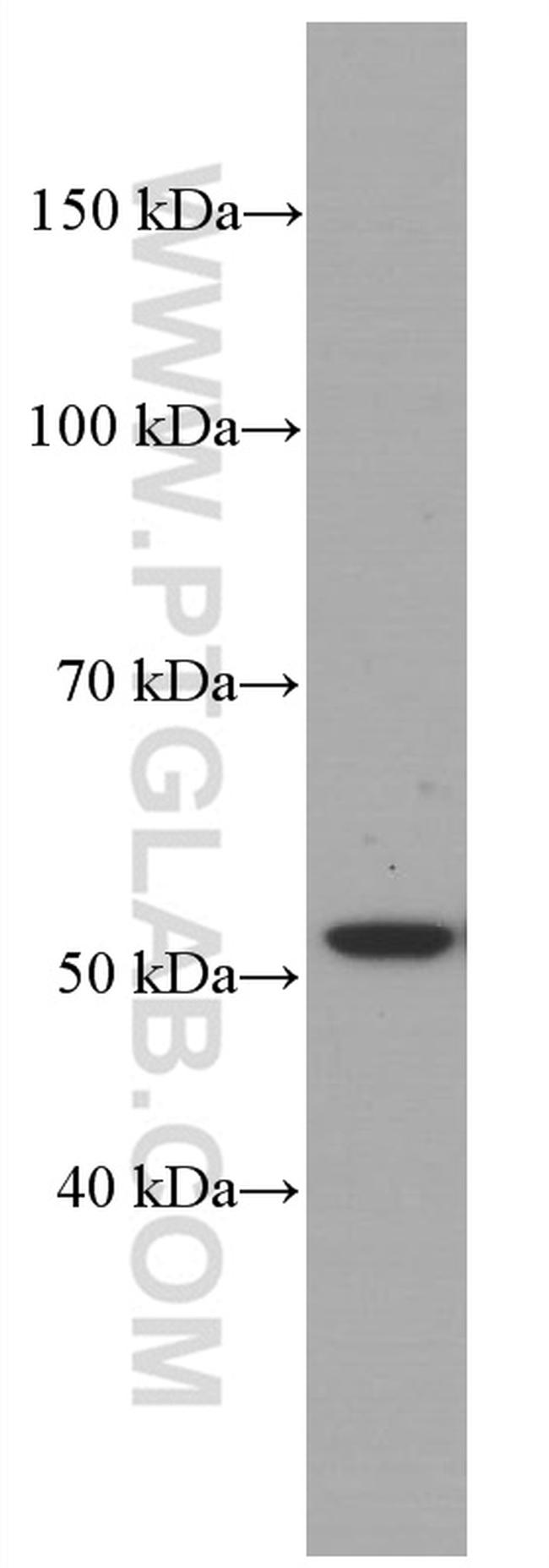 Cytokeratin 7 Antibody in Western Blot (WB)