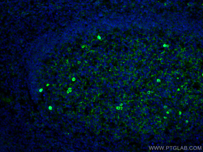 IGHM Antibody in Immunohistochemistry (PFA fixed) (IHC (PFA))