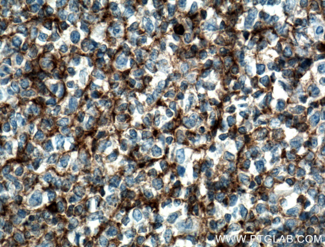 IGHM Antibody in Immunohistochemistry (Paraffin) (IHC (P))