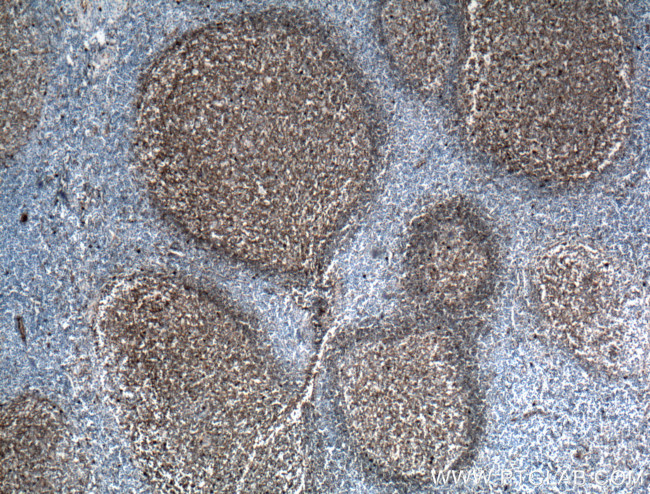 IGHM Antibody in Immunohistochemistry (Paraffin) (IHC (P))