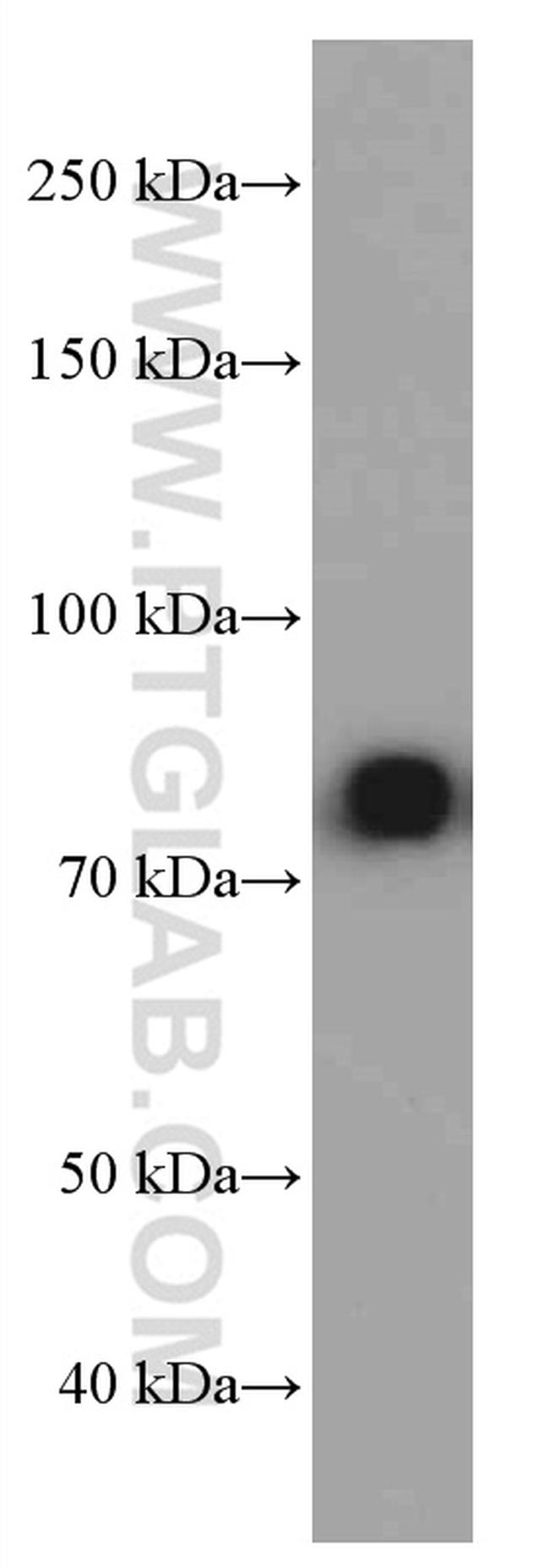 IGHM Antibody in Western Blot (WB)