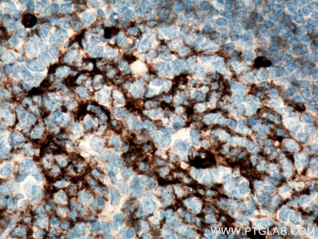 IGHM Antibody in Immunohistochemistry (Paraffin) (IHC (P))