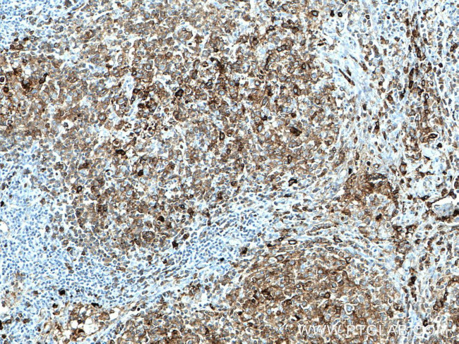 IGHM Antibody in Immunohistochemistry (Paraffin) (IHC (P))