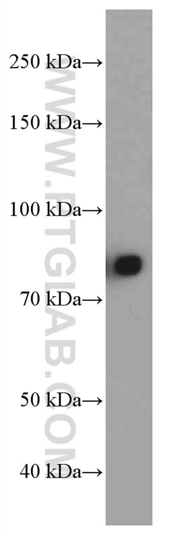 IGHM Antibody in Western Blot (WB)