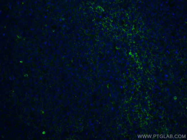 IGHM Antibody in Immunohistochemistry (PFA fixed) (IHC (PFA))