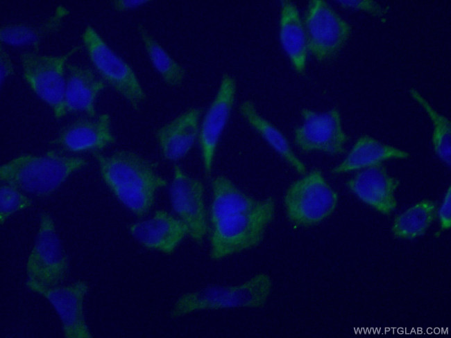 G3BP1 Antibody in Immunocytochemistry (ICC/IF)