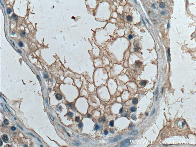 G3BP1 Antibody in Immunohistochemistry (Paraffin) (IHC (P))