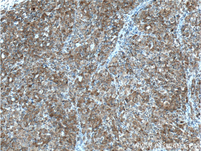 G3BP1 Antibody in Immunohistochemistry (Paraffin) (IHC (P))