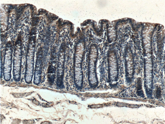 G3BP1 Antibody in Immunohistochemistry (Paraffin) (IHC (P))