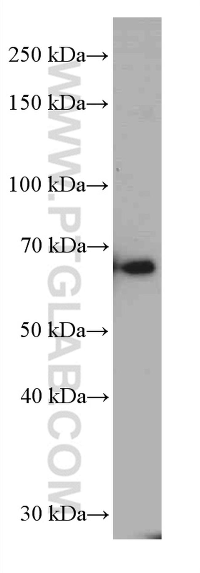 G3BP1 Antibody in Western Blot (WB)