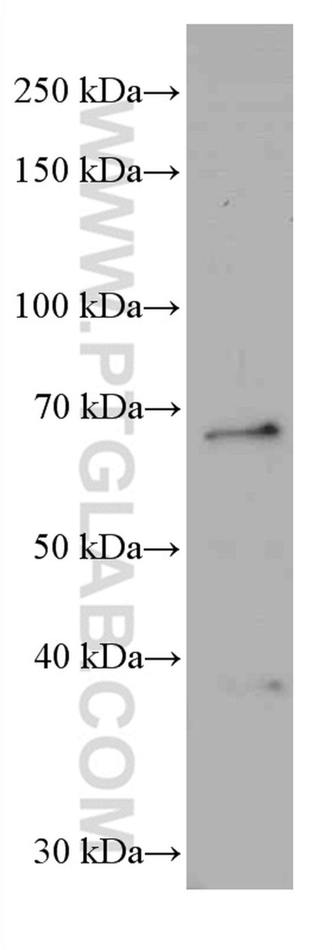 G3BP1 Antibody in Western Blot (WB)