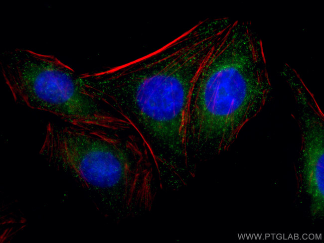 CLTC Antibody in Immunocytochemistry (ICC/IF)