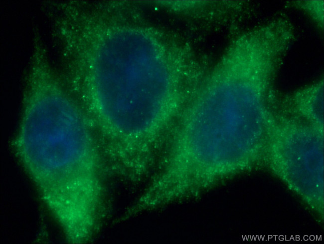 CLTC Antibody in Immunocytochemistry (ICC/IF)