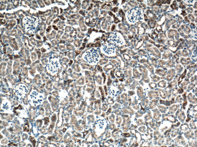 CLTC Antibody in Immunohistochemistry (Paraffin) (IHC (P))