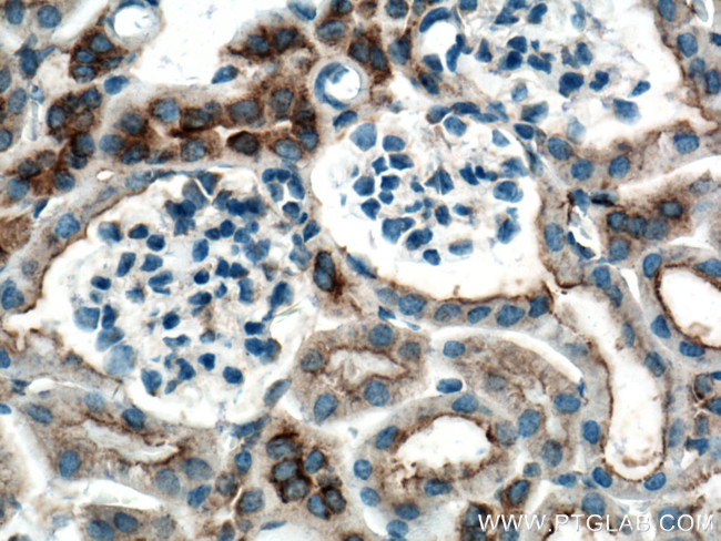 CLTC Antibody in Immunohistochemistry (Paraffin) (IHC (P))