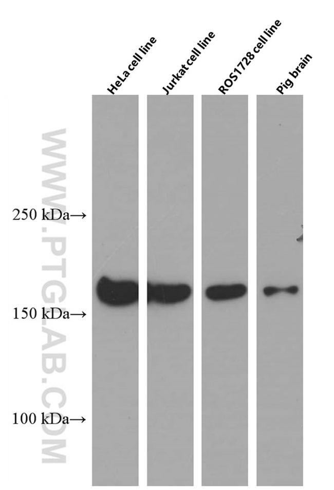 CLTC Antibody in Western Blot (WB)