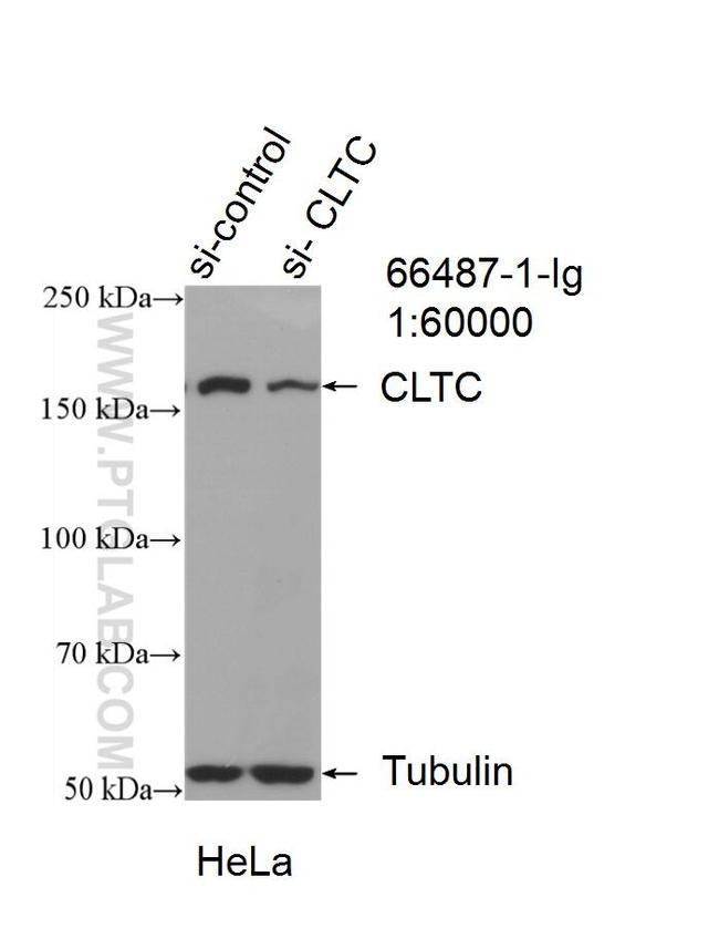 CLTC Antibody in Western Blot (WB)