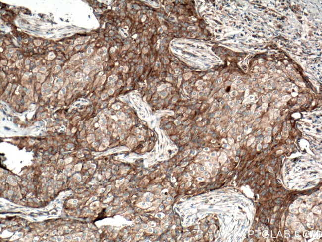 CLTC Antibody in Immunohistochemistry (Paraffin) (IHC (P))