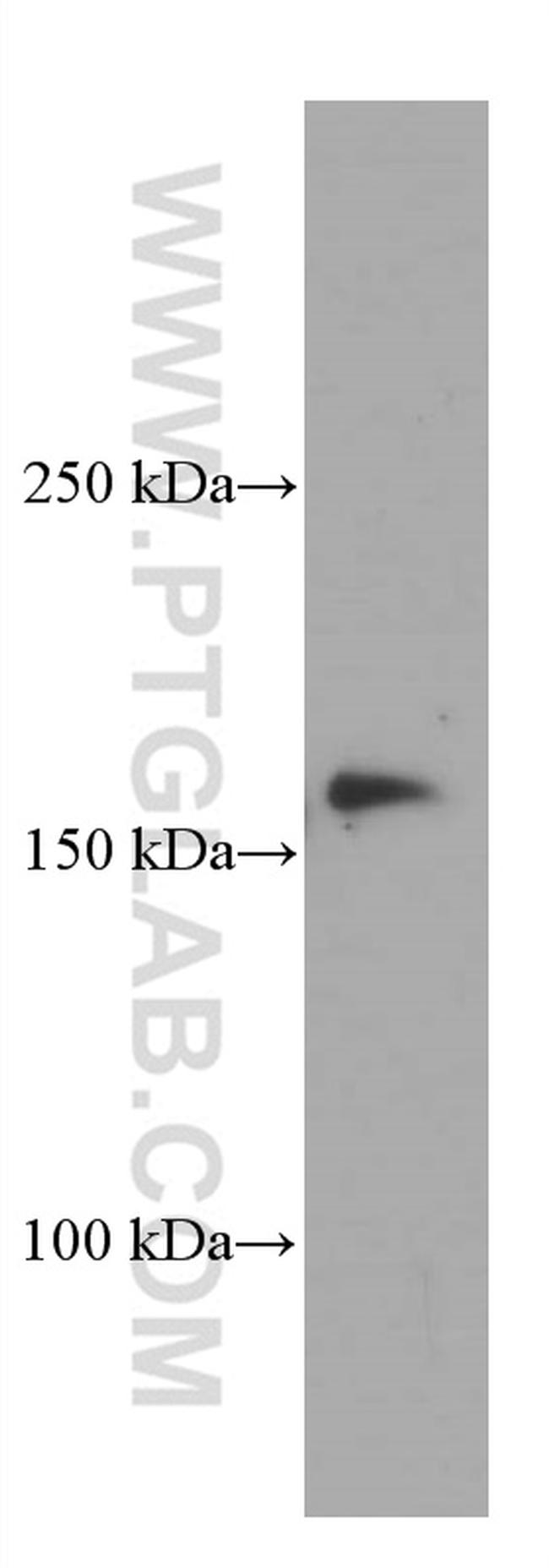 CLTC Antibody in Western Blot (WB)