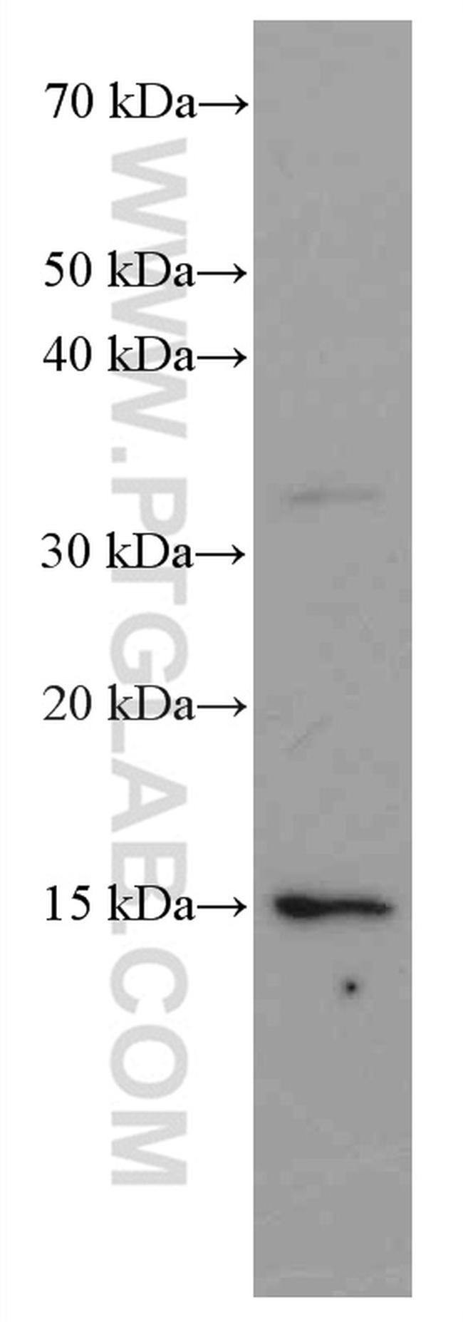 VAMP3/Cellubrevin Antibody in Western Blot (WB)